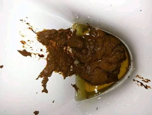 Kotoran berceceran di kloset